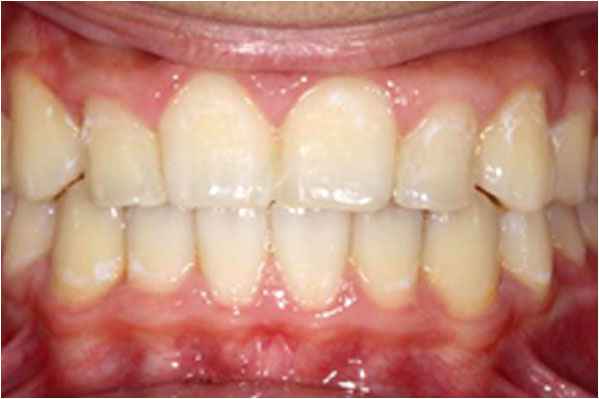 Orthodontics After